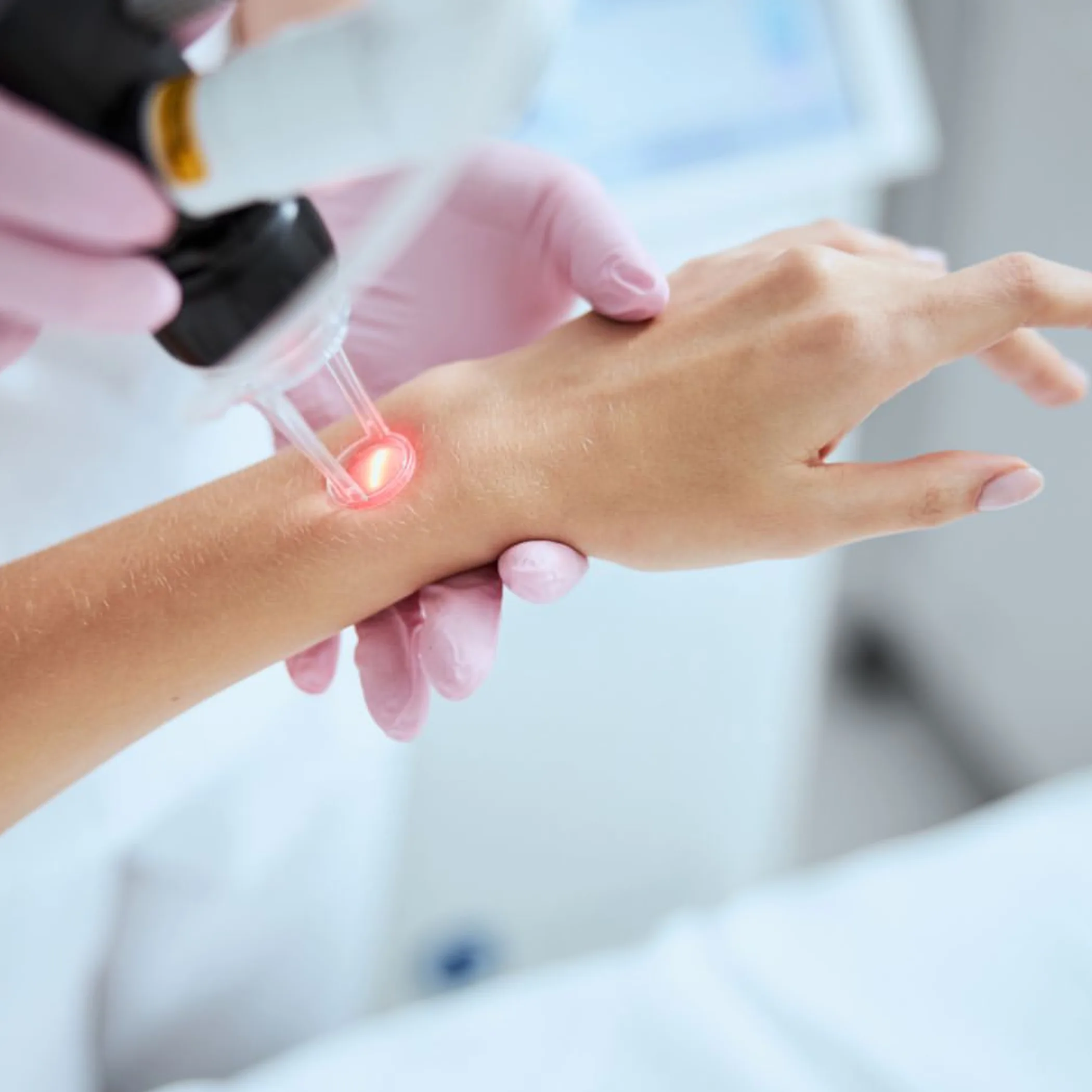 skin laser resurfacing recovery treatment